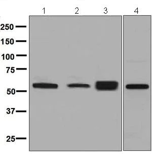 Western blot - Anti-LACTB antibody [EPR8502] - BSA and Azide free (AB248369)
