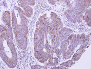 Immunohistochemistry (Formalin/PFA-fixed paraffin-embedded sections) - Anti-LACTB2 antibody (AB154267), expandable thumbnail