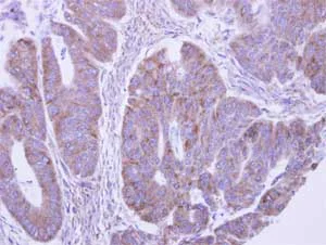 Immunohistochemistry (Formalin/PFA-fixed paraffin-embedded sections) - Anti-LACTB2 antibody (AB154267)
