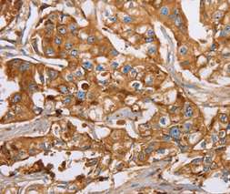Immunohistochemistry (Formalin/PFA-fixed paraffin-embedded sections) - Anti-Lactoferrin antibody (AB197811)