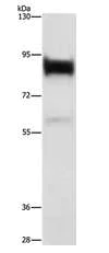 Western blot - Anti-Lactoferrin antibody (AB197811)