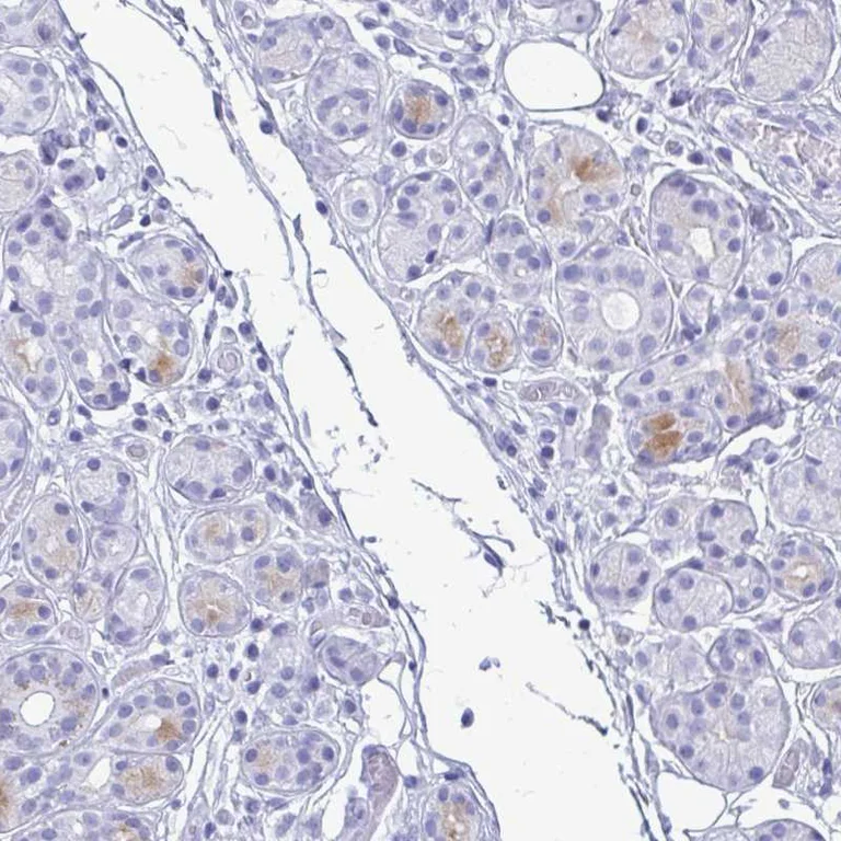 Immunohistochemistry (Formalin/PFA-fixed paraffin-embedded sections) - Anti-Lactoferrin antibody (AB262901)