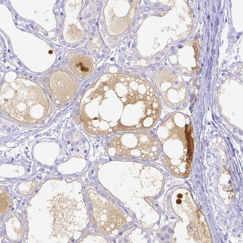 Immunohistochemistry (Formalin/PFA-fixed paraffin-embedded sections) - Anti-Lactoferrin antibody (AB262901)
