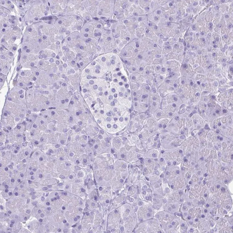 Immunohistochemistry (Formalin/PFA-fixed paraffin-embedded sections) - Anti-Lactoferrin antibody (AB262901)