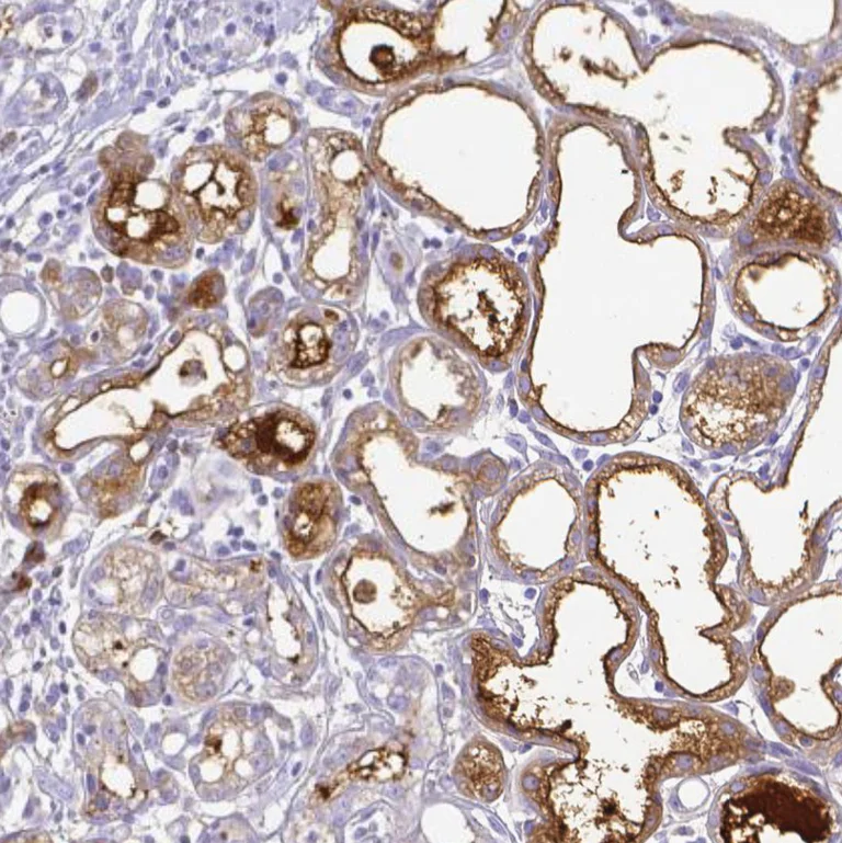 Immunohistochemistry (Formalin/PFA-fixed paraffin-embedded sections) - Anti-Lactoferrin antibody (AB262902)