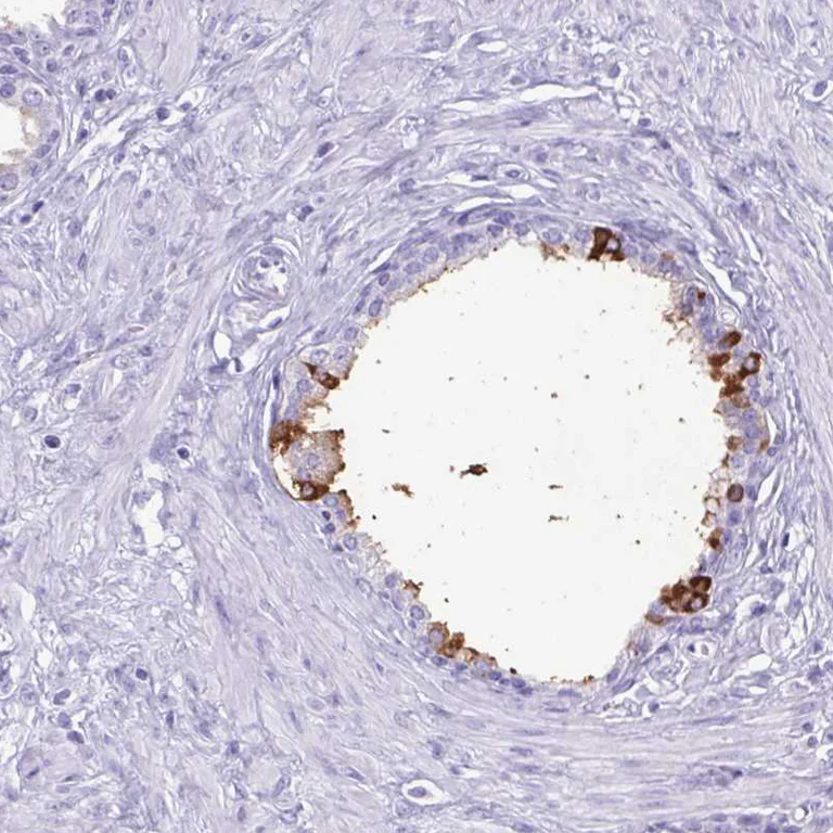 Immunohistochemistry (Formalin/PFA-fixed paraffin-embedded sections) - Anti-Lactoferrin antibody (AB262902)