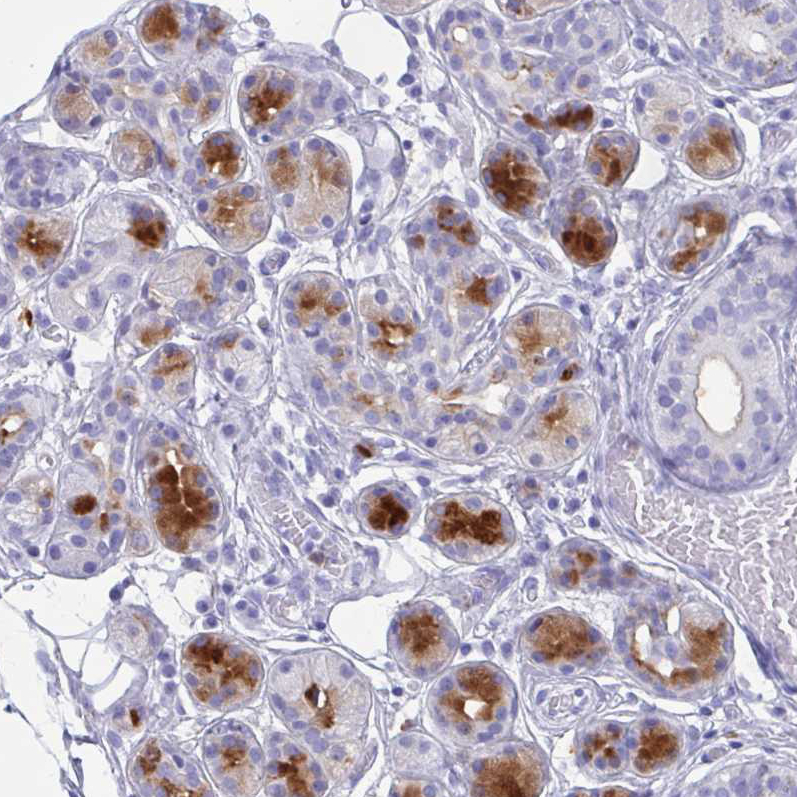 Immunohistochemistry (Formalin/PFA-fixed paraffin-embedded sections) - Anti-Lactoferrin antibody (AB262902)
