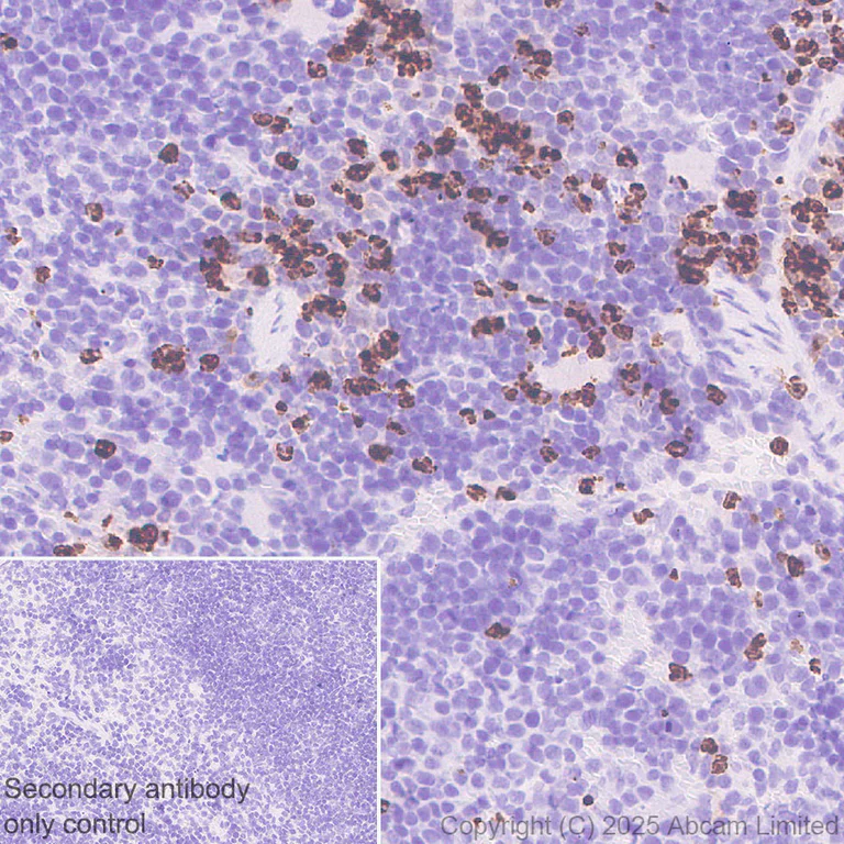 Immunohistochemistry (Formalin/PFA-fixed paraffin-embedded sections) - Anti-Lactoferrin antibody [EPR30217-521R] (AB325119)