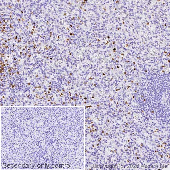 Immunohistochemistry (Formalin/PFA-fixed paraffin-embedded sections) - Anti-Lactoferrin antibody [EPR30415-7] (AB326326)