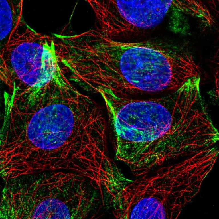 Immunocytochemistry/ Immunofluorescence - Anti-LAD1 antibody (AB246885)
