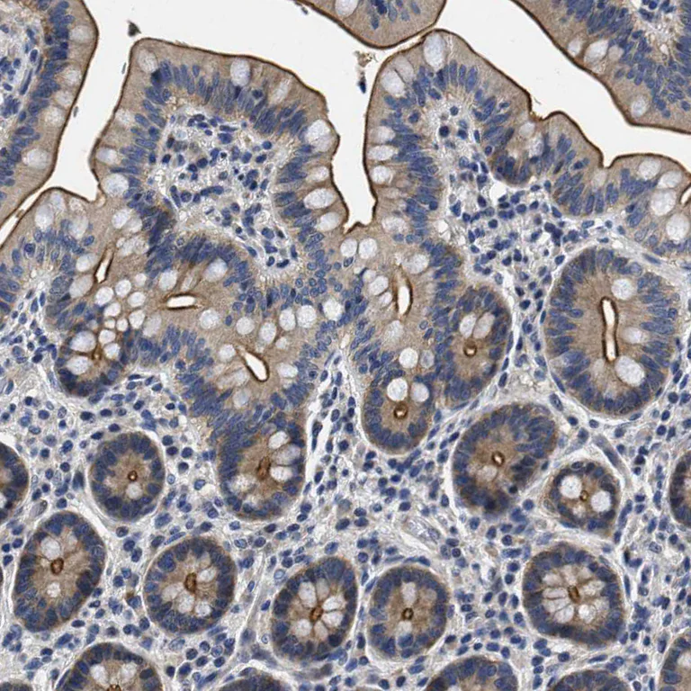 Immunohistochemistry (Formalin/PFA-fixed paraffin-embedded sections) - Anti-LAD1 antibody (AB246885)