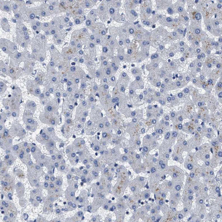 Immunohistochemistry (Formalin/PFA-fixed paraffin-embedded sections) - Anti-LAD1 antibody (AB246885)