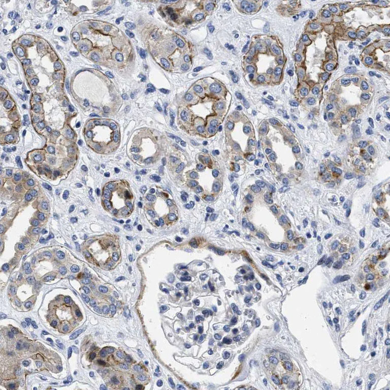 Immunohistochemistry (Formalin/PFA-fixed paraffin-embedded sections) - Anti-LAD1 antibody (AB246885)