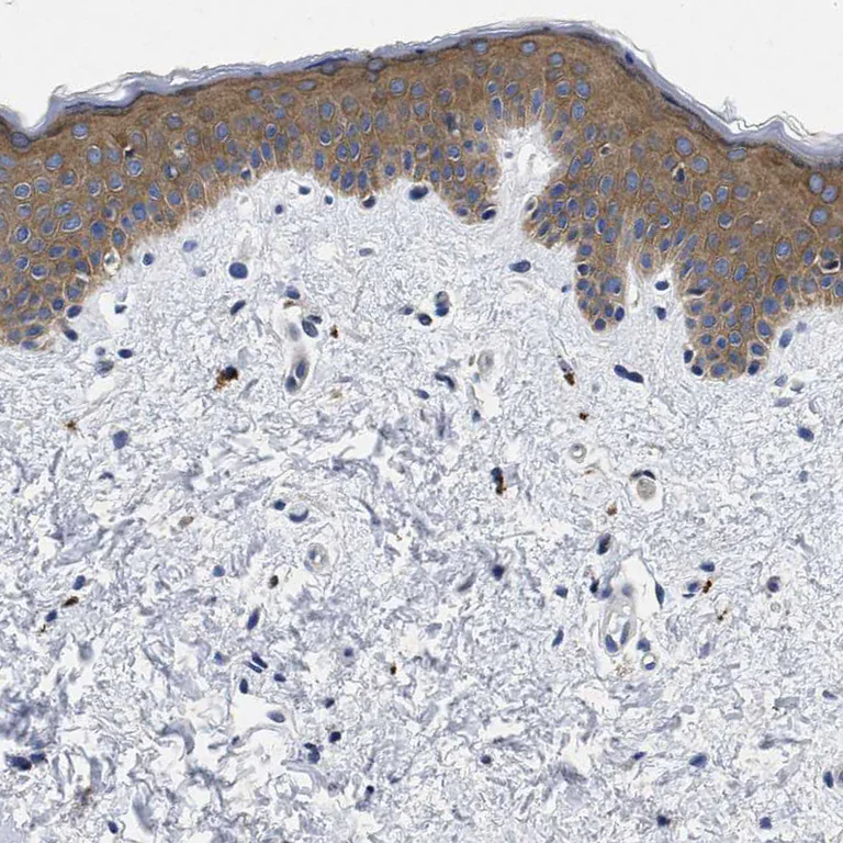 Immunohistochemistry (Formalin/PFA-fixed paraffin-embedded sections) - Anti-LAD1 antibody (AB246885)
