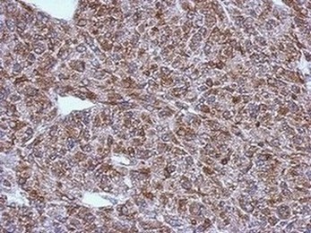 Immunohistochemistry (Formalin/PFA-fixed paraffin-embedded sections) - Anti-LAE antibody (AB151456), expandable thumbnail