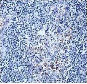 Immunohistochemistry (Formalin/PFA-fixed paraffin-embedded sections) - Anti-LAF4 antibody (AB106231)