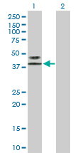 Western blot - Anti-LAG-3 antibody (AB169282), expandable thumbnail