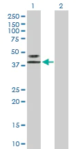 Western blot - Anti-LAG-3 antibody (AB169282)
