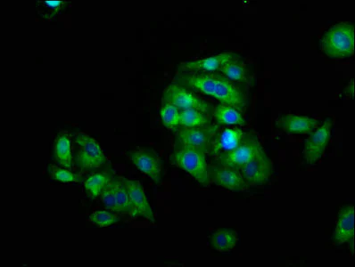 Immunocytochemistry/ Immunofluorescence - Anti-LAG-3 antibody (AB235907)