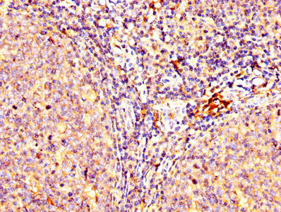 Immunohistochemistry (Formalin/PFA-fixed paraffin-embedded sections) - Anti-LAG-3 antibody (AB235907), expandable thumbnail