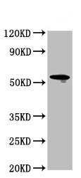 Western blot - Anti-LAG-3 antibody (AB235907), expandable thumbnail