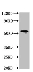 Western blot - Anti-LAG-3 antibody (AB235907)