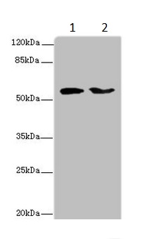 Western blot - Anti-LAG-3 antibody (AB235907), expandable thumbnail