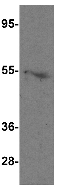 Western blot - Anti-LAG-3 antibody (AB254578), expandable thumbnail