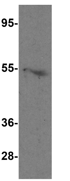 Western blot - Anti-LAG-3 antibody (AB254578)