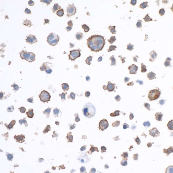 Immunocytochemistry - Anti-LAG-3 antibody [BLR027F] (AB243884), expandable thumbnail