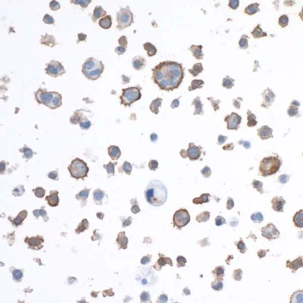 Immunocytochemistry - Anti-LAG-3 antibody [BLR027F] (AB243884)