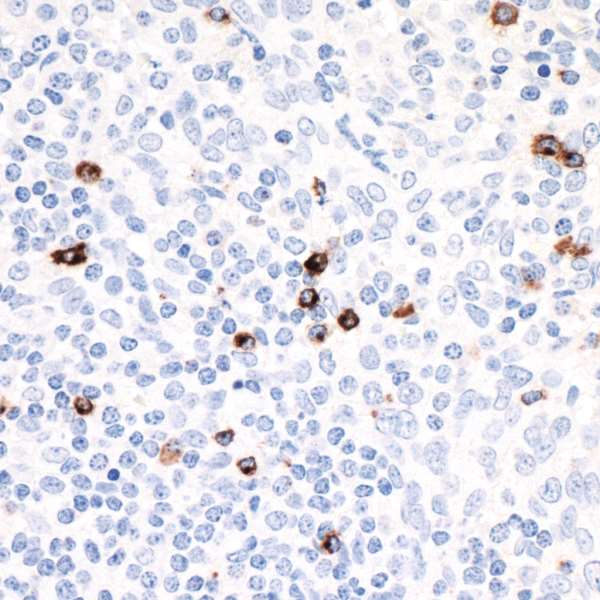 Immunohistochemistry (Formalin/PFA-fixed paraffin-embedded sections) - Anti-LAG-3 antibody [BLR027F] (AB243884), expandable thumbnail