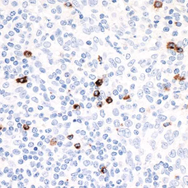 Immunohistochemistry (Formalin/PFA-fixed paraffin-embedded sections) - Anti-LAG-3 antibody [BLR027F] (AB243884)