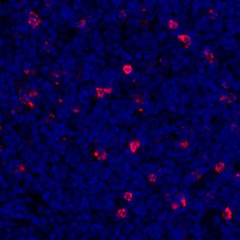 Immunohistochemistry (Formalin/PFA-fixed paraffin-embedded sections) - Anti-LAG-3 antibody [BLR027F] (AB243884), expandable thumbnail