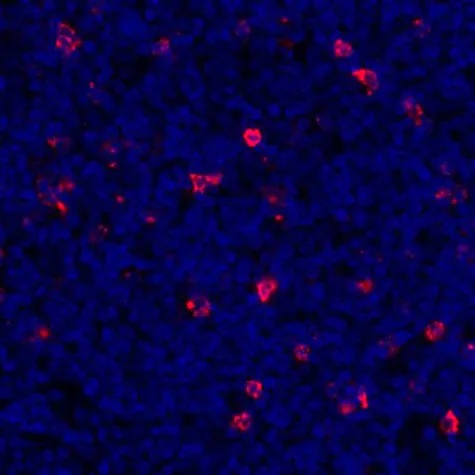 Immunohistochemistry (Formalin/PFA-fixed paraffin-embedded sections) - Anti-LAG-3 antibody [BLR027F] (AB243884)