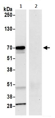 Immunoprecipitation - Anti-LAG-3 antibody [BLR027F] (AB243884), expandable thumbnail