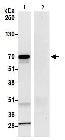 Immunoprecipitation - Anti-LAG-3 antibody [BLR027F] (AB243884)