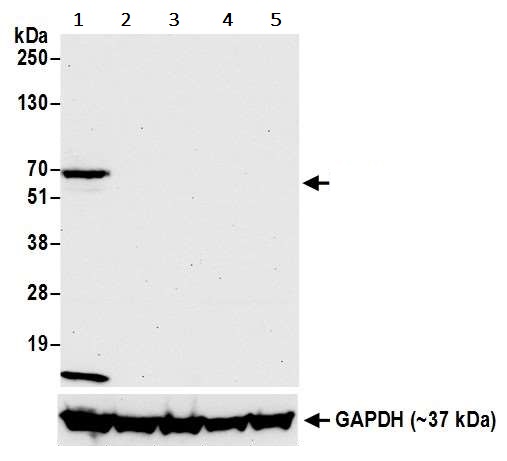 Western blot - Anti-LAG-3 antibody [BLR027F] (AB243884), expandable thumbnail