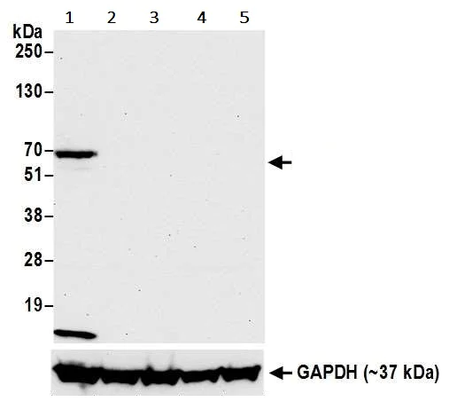 Western blot - Anti-LAG-3 antibody [BLR027F] (AB243884)