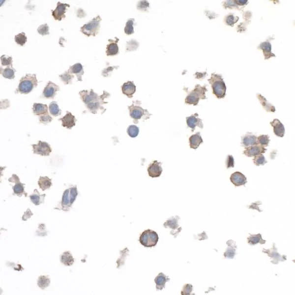 Immunocytochemistry - Anti-LAG-3 antibody [BLR028F] - BSA free (AB243885)