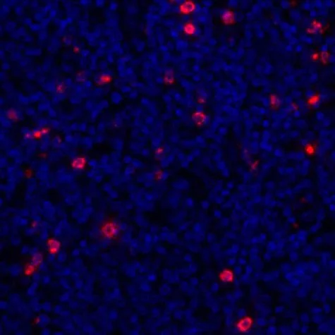 Immunohistochemistry (Formalin/PFA-fixed paraffin-embedded sections) - Anti-LAG-3 antibody [BLR028F] - BSA free (AB243885)