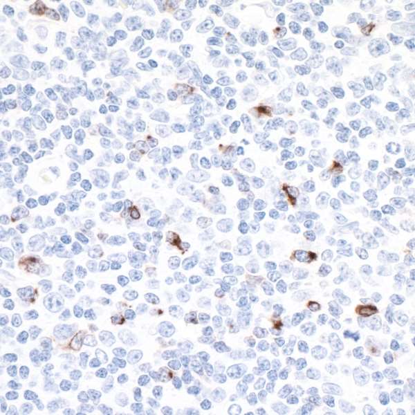 Immunohistochemistry (Formalin/PFA-fixed paraffin-embedded sections) - Anti-LAG-3 antibody [BLR028F] - BSA free (AB243885)