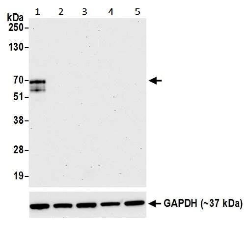 Western blot - Anti-LAG-3 antibody [BLR028F] - BSA free (AB243885)