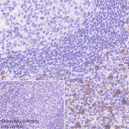 Immunohistochemistry (Formalin/PFA-fixed paraffin-embedded sections) - Anti-LAG-3 antibody [CAL25] (AB237718), expandable thumbnail