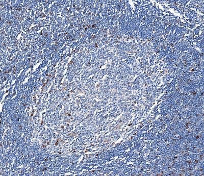 Immunohistochemistry (Formalin/PFA-fixed paraffin-embedded sections) - Anti-LAG-3 antibody [CAL25] (ab237718), expandable thumbnail