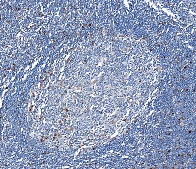 Immunohistochemistry (Formalin/PFA-fixed paraffin-embedded sections) - Anti-LAG-3 antibody [CAL25] (AB237718)