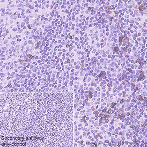 Immunohistochemistry (Formalin/PFA-fixed paraffin-embedded sections) - Anti-LAG-3 antibody [CAL26] (AB237719)