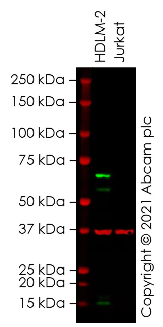 Western blot - Anti-LAG-3 antibody [CAL26] (AB237719)