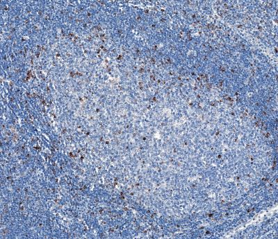 Immunohistochemistry (Formalin/PFA-fixed paraffin-embedded sections) - Anti-LAG-3 antibody [CAL26] - BSA and Azide free (AB251605), expandable thumbnail