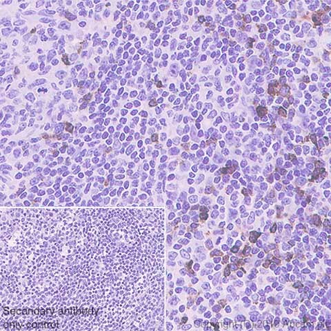 Immunohistochemistry (Formalin/PFA-fixed paraffin-embedded sections) - Anti-LAG-3 antibody [CAL26] - BSA and Azide free (AB251605), expandable thumbnail